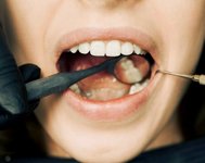 teeth and gums routine checkup
